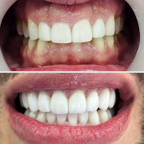 Dental Tourism Colombia (Cartagena, Dr. Julio Oliver)