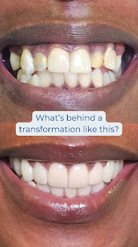 Dental Tourism Colombia (Cartagena, Dr. Julio Oliver)