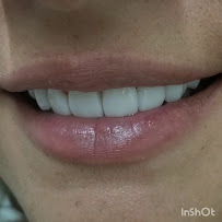 Dental Tourism Colombia (Cartagena, Dr. Julio Oliver)