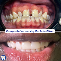 Dental Tourism Colombia (Cartagena, Dr. Julio Oliver)