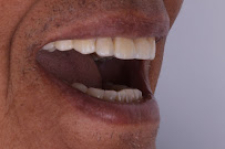 Odontología Dr. Alfonso Cuadro | Cartagena Colombia