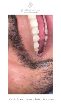 Odontología Dr. Alfonso Cuadro | Cartagena Colombia