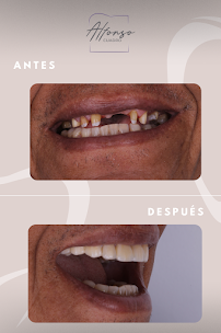 Odontología Dr. Alfonso Cuadro | Cartagena Colombia