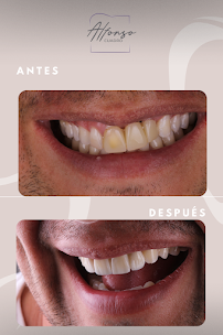 Odontología Dr. Alfonso Cuadro | Cartagena Colombia