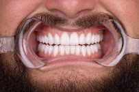 Clinica Dental Rehabilitadora Oral, Dentist U.Javeriana | speaks fluent English | Dental Tourism I