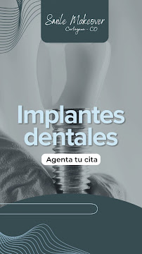 Clinica Dental Smile Makeover Cartagena l Odontólogos Cartagena l Fluent English