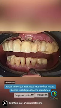 Odontologia en Cartagena Clinident Odontología Integral y Estetica