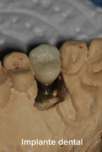 Odontologia en Cartagena Clinident Odontología Integral y Estetica