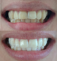 Cartagena English Speaking Dentist