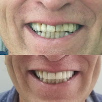 Cartagena English Speaking Dentist
