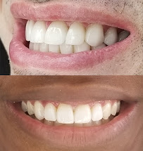 Cartagena English Speaking Dentist