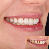 DENTAL SMILE CONCEPT