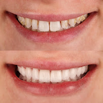 DENTAL SMILE CONCEPT
