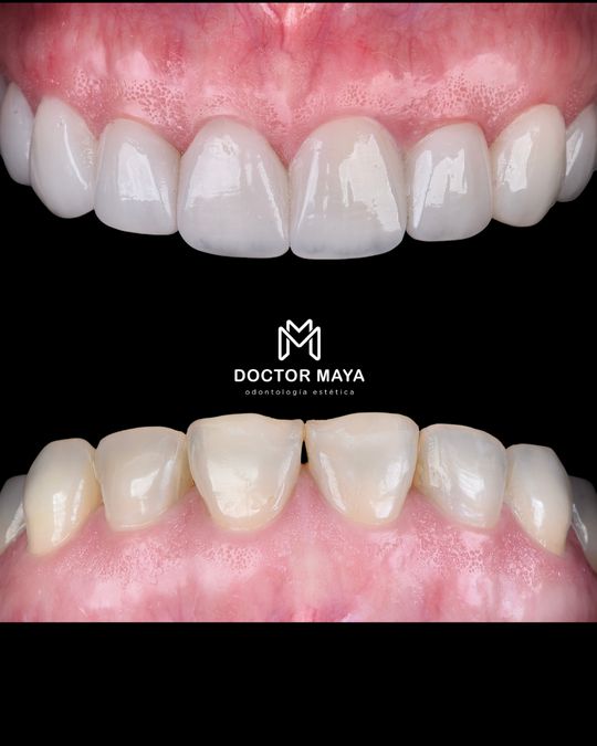 Doctor Maya - Diseño de Sonrisa Barranquilla - dental clinic in Barranquilla