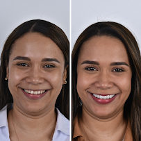 Doctor Maya - Diseño de Sonrisa Barranquilla