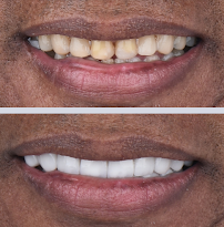 Doctor Maya - Diseño de Sonrisa Barranquilla