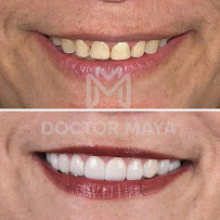 Doctor Maya - Diseño de Sonrisa Barranquilla