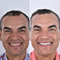 Doctor Maya - Diseño de Sonrisa Barranquilla