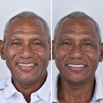 Doctor Maya - Diseño de Sonrisa Barranquilla