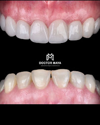 Doctor Maya - Diseño de Sonrisa Barranquilla