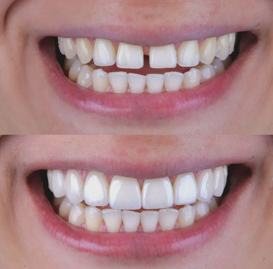 Dr Eduardo Coll | Diseños de Sonrisa en Barranquilla - dental clinic in Barranquilla