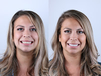 Dr Eduardo Coll | Diseños de Sonrisa en Barranquilla