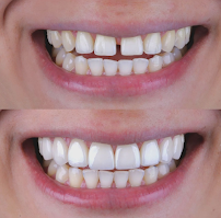 Dr Eduardo Coll | Diseños de Sonrisa en Barranquilla in Barranquilla, Colombia