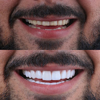 Dr Eduardo Coll | Diseños de Sonrisa en Barranquilla