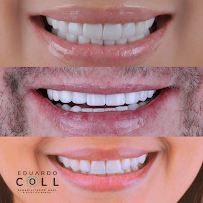 Dr Eduardo Coll | Diseños de Sonrisa en Barranquilla