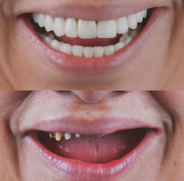 Dr Eduardo Coll | Diseños de Sonrisa en Barranquilla