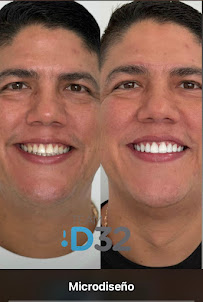 Clínica odontológica team D32 Odontología especialista en ortodoncia, diseño de sonrisa, implatologia oral