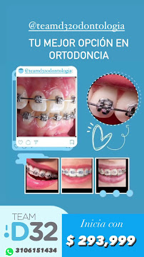 Clínica odontológica team D32 Odontología especialista en ortodoncia, diseño de sonrisa, implatologia oral