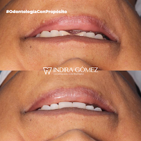 Odontología con Propósito - Dra. Indira Gómez