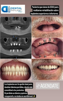 Dental Implant Plus - Odontología, Implantes, Ortodoncia, Diseño Sonrisa