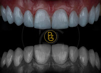 BG Odontología Especializada | Dra. Bellys Gutierrez Odontologa Barranquilla