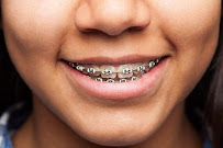 BG Odontología Especializada | Dra. Bellys Gutierrez Odontologa Barranquilla