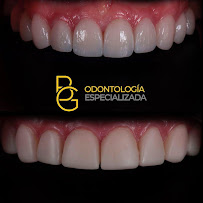 BG Odontología Especializada | Dra. Bellys Gutierrez Odontologa Barranquilla