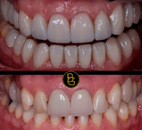 BG Odontología Especializada | Dra. Bellys Gutierrez Odontologa Barranquilla