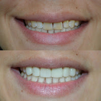 Dental Costa Rica