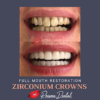 Prisma Dental