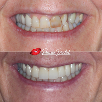 Prisma Dental