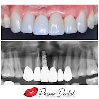 Prisma Dental