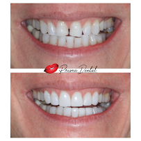 Prisma Dental