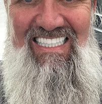 Dr. Delfín Barquero Dentista