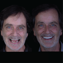 Dr. Delfín Barquero Dentista