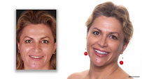 Dr. Delfín Barquero Dentista