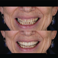 Dr. Delfín Barquero Dentista