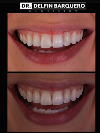 Dr. Delfín Barquero Dentista