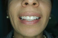 Dentavac Dental Clinic