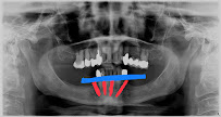 Dentavac Dental Clinic